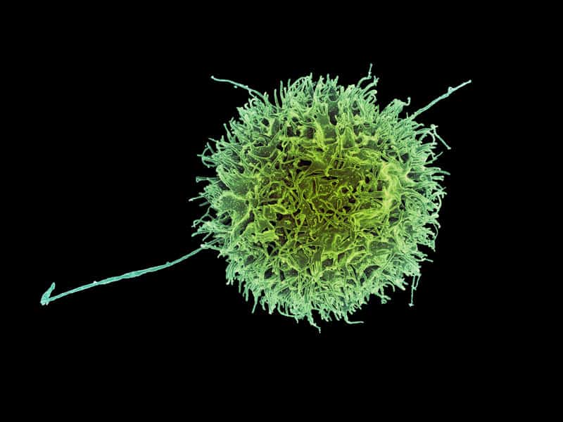 A natural killer cell